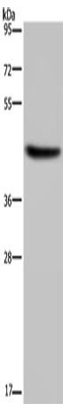 Western Blot analysis of Human adrenal gland tissue using HSD3B1 Polyclonal Antibody at dilution of 1:250