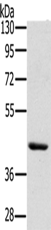 Western Blot analysis of Skov3 cell using HSD3B7 Polyclonal Antibody at dilution of 1:400