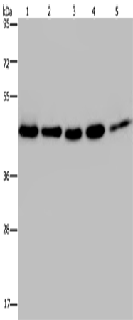 Western Blot analysis of 231, A431, Raji, Jurkat and HepG2 cell using HSP40-4 Polyclonal Antibody at dilution of 1:500