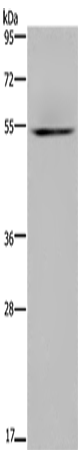 Western Blot analysis of Human kidney tissue using HYAL3 Polyclonal Antibody at dilution of 1:400