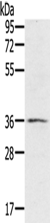 Western Blot analysis of TM4 cell using p53RFP Polyclonal Antibody at dilution of 1:400