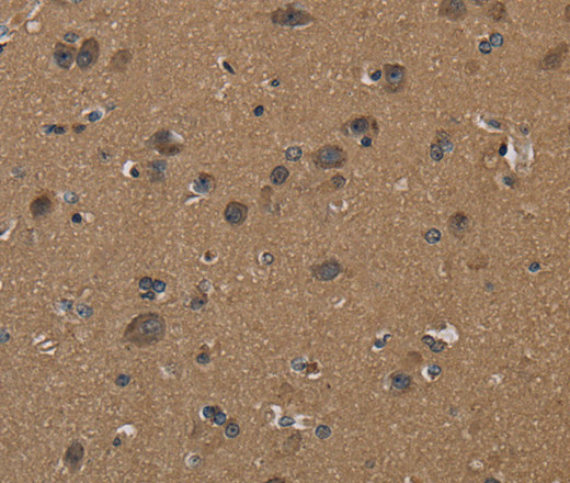 Immunohistochemistry of paraffin-embedded Human brain  using CD242 Polyclonal Antibody at dilution of 1:50