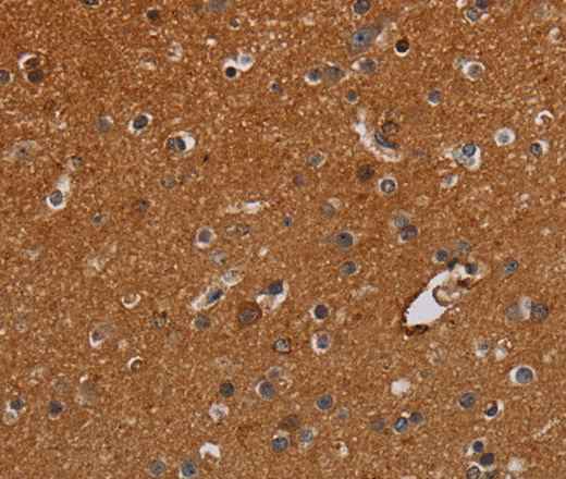 Immunohistochemistry of paraffin-embedded Human brain  tissue using IFRD1 Polyclonal Antibody at dilution 1:30