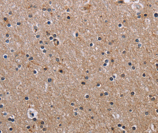 Immunohistochemistry of paraffin-embedded Human brain  tissue using FCGR3A Polyclonal Antibody at dilution 1:60