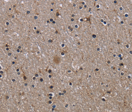 Immunohistochemistry of paraffin-embedded Human brain using ITGB2 Polyclonal Antibody at dilution of 1:50