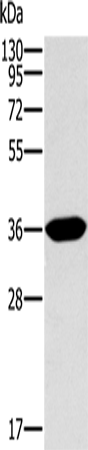 Western Blot analysis of Human fetal intestine tissue using ITLN1 Polyclonal Antibody at dilution of 1:400