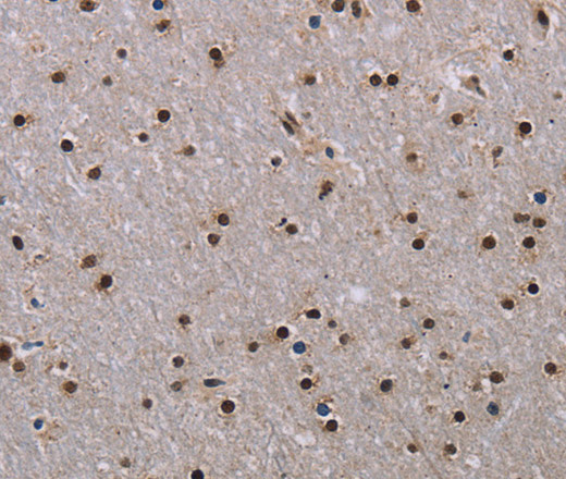 Immunohistochemistry of paraffin-embedded Human brain using JMJD6 Polyclonal Antibody at dilution of 1:40