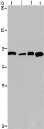 Western Blot analysis of Mouse heart tissue and Hela cell, HUVEC cell and Mouse skin tissue using Catenin gamma Polyclonal Antibody at dilution of 1:1150