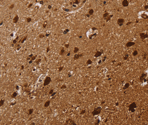 Immunohistochemistry of paraffin-embedded Human brain tissue using KARS Polyclonal Antibody at dilution 1:30