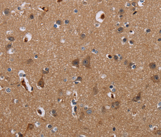 Immunohistochemistry of paraffin-embedded Human brain  tissue using KLHL1 Polyclonal Antibody at dilution 1:30