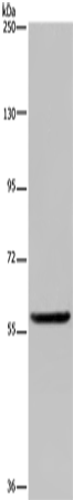 Western Blot analysis of Human fetal brain tissue using LBR Polyclonal Antibody at dilution of 1:300