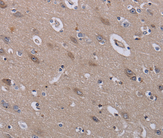 Immunohistochemistry of paraffin-embedded Human brain tissue using P3H3 Polyclonal Antibody at dilution 1:40