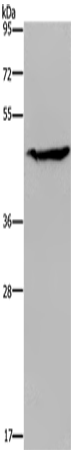 Western Blot analysis of K562 cell using ACP6 Polyclonal Antibody at dilution of 1:200