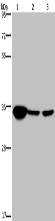 Western Blot analysis of Human testis tissue, 293T and A 172 cell using LZTFL1 Polyclonal Antibody at dilution of 1:300