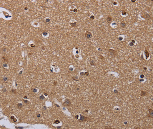 Immunohistochemistry of paraffin-embedded Human brain  using MCTS1 Polyclonal Antibody at dilution of 1:60