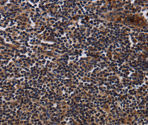 Immunohistochemistry of paraffin-embedded Human tonsil tissue using NTMT1 Polyclonal Antibody at dilution 1:40