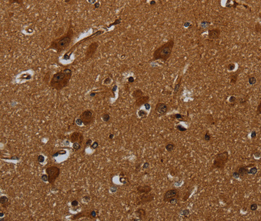 Immunohistochemistry of paraffin-embedded Human brain  tissue using ENTPD7 Polyclonal Antibody at dilution 1:40