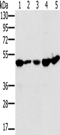 Western Blot analysis of 231 and Jurkat cell, Mouse liver tissue, 293T and hela cell using PSMC2 Polyclonal Antibody at dilution of 1:400