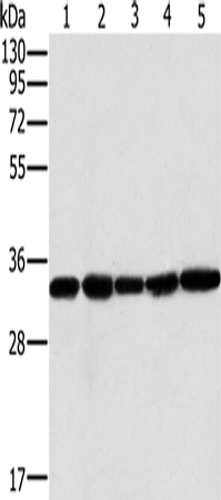 Western Blot analysis of Human testis tissue and K562 cell, PC3 cell and Human liver cancer tissue, hela cell using MTCH2 Polyclonal Antibody at dilution of 1:400