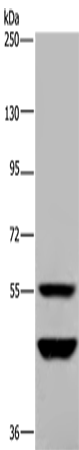 Western Blot analysis of Human testis tissue using MTF2 Polyclonal Antibody at dilution of 1:400