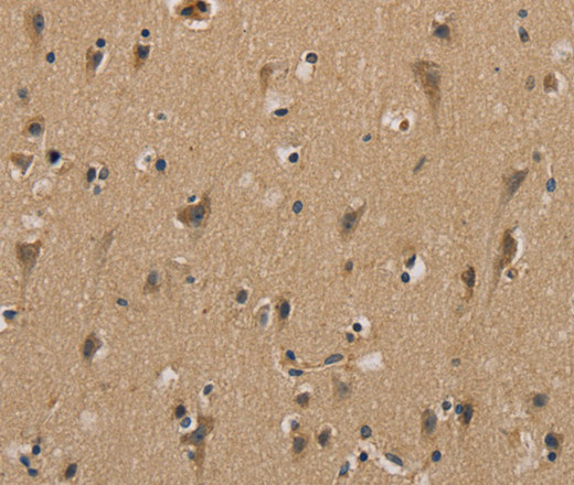 Immunohistochemistry of paraffin-embedded Human brain  using MYL3 Polyclonal Antibody at dilution of 1:40