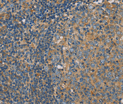 Immunohistochemistry of paraffin-embedded Human tonsil using CLIC1 Polyclonal Antibody at dilution of 1:30