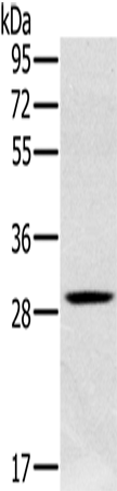 Western Blot analysis of Human testis tissue using CLIC1 Polyclonal Antibody at dilution of 1:400