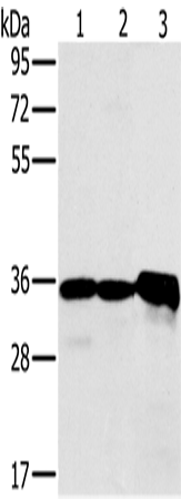 Western Blot analysis of Mouse kidney tissue and Jurkat cell, Mouse heart tissue using NDUFA9 Polyclonal Antibody at dilution of 1:400