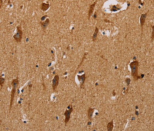 Immunohistochemistry of paraffin-embedded Human brain  using NDUFS3 Polyclonal Antibody at dilution of 1:40