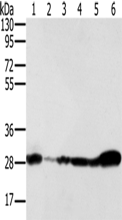 Western Blot analysis of 293T, NIH/3T3, Raw264.7 and hela cell, Human fetal brain and Mouse brain tissue using NDUFS3 Polyclonal Antibody at dilution of 1:350