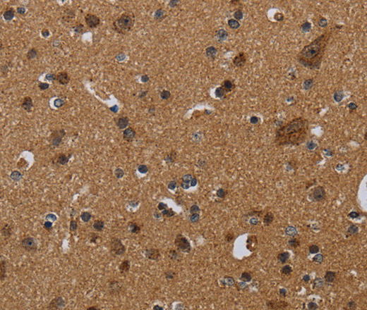 Immunohistochemistry of paraffin-embedded Human brain  using NDUFS8 Polyclonal Antibody at dilution of 1:50