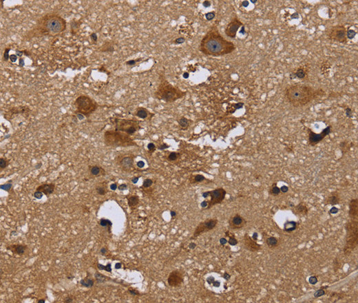 Immunohistochemistry of paraffin-embedded Human brain  tissue using NCSTN Polyclonal Antibody at dilution 1:50