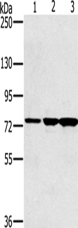 Western Blot analysis of Human testis tissue, Jurkat cell and Mouse liver tissue using KIRREL2 Polyclonal Antibody at dilution of 1:500