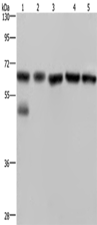Western Blot analysis of Jurkat cell and Human brain malignant glioma tissue, PC3, K562 and A549 cell using NUP62 Polyclonal Antibody at dilution of 1:300