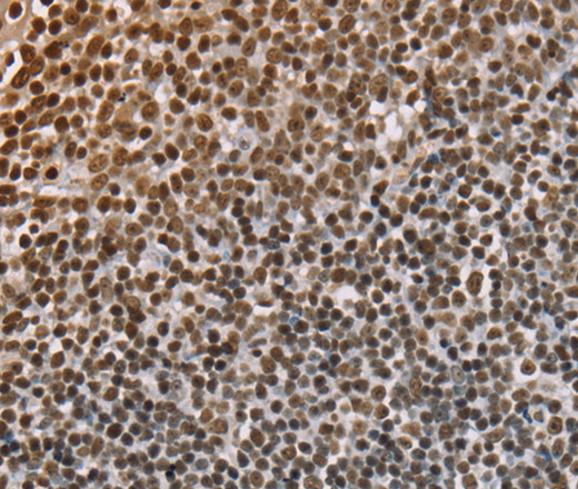 Immunohistochemistry of paraffin-embedded Human tonsil using NUP50 Polyclonal Antibody at dilution of 1:30