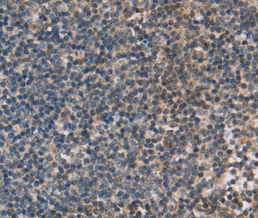 Immunohistochemistry of paraffin-embedded Human tonsil using OTC Polyclonal Antibody at dilution of 1:40