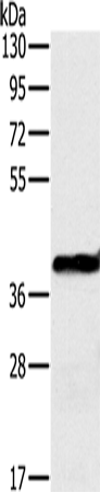 Western Blot analysis of Mouse liver tissue using OTC Polyclonal Antibody at dilution of 1:650