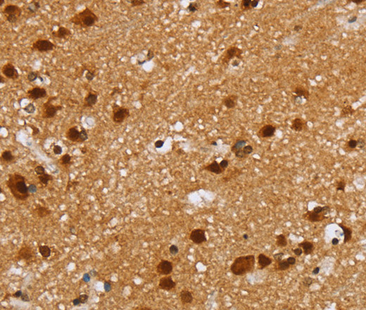 Immunohistochemistry of paraffin-embedded Human brain tissue using ZMAT3 Polyclonal Antibody at dilution 1:30