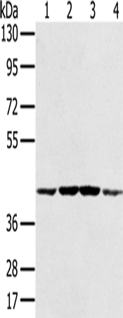 Western Blot analysis of Hela, K562, Raji and Jurkat cell using PAICS Polyclonal Antibody at dilution of 1:550