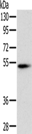 Western Blot analysis of Mouse pancreas tissue using PNLIP Polyclonal Antibody at dilution of 1:400