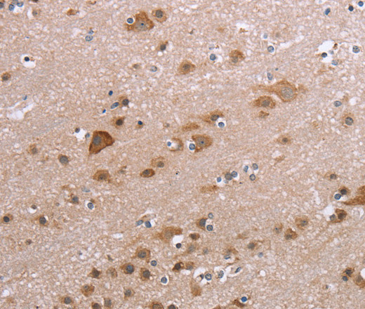 Immunohistochemistry of paraffin-embedded Human brain using PPP2R3C Polyclonal Antibody at dilution of 1:30