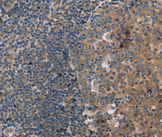 Immunohistochemistry of paraffin-embedded Human tonsil using PPP2R3C Polyclonal Antibody at dilution of 1:30