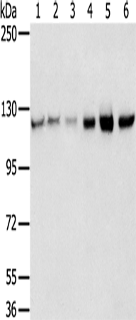 Western Blot analysis of 823, A549, K562, 293T, hepg2 and huvec cell using RBM5 Polyclonal Antibody at dilution of 1:450