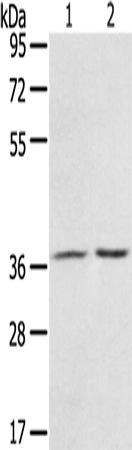 Western Blot analysis of Mouse stomach tissue and A431 cell using PDLIM4 Polyclonal Antibody at dilution of 1:800