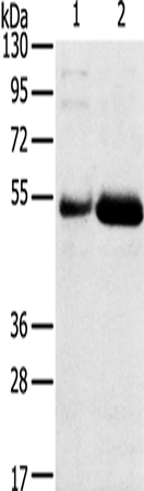 Western Blot analysis of Human placenta and stomach cancer tissue using SAMD3 Polyclonal Antibody at dilution of 1:400