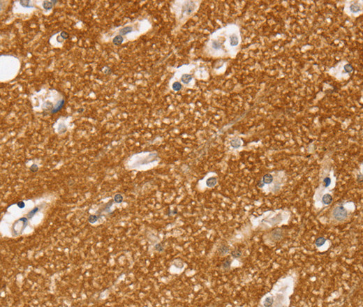 Immunohistochemistry of paraffin-embedded Human brain  using SLC25A13 Polyclonal Antibody at dilution of 1:35