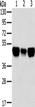Western Blot analysis of Lovo, A549 and hela cell using TRIM21 Polyclonal Antibody at dilution of 1:400