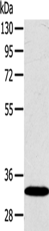 Western Blot analysis of Human fetal liver tissue using SULT2A1 Polyclonal Antibody at dilution of 1:650