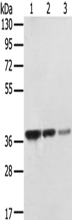 Western Blot analysis of MCF7, A172 and hepg2 cell using STX16 Polyclonal Antibody at dilution of 1:400