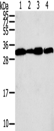 Western Blot analysis of A375, A431, lovo and hela cell using STX10 Polyclonal Antibody at dilution of 1:800